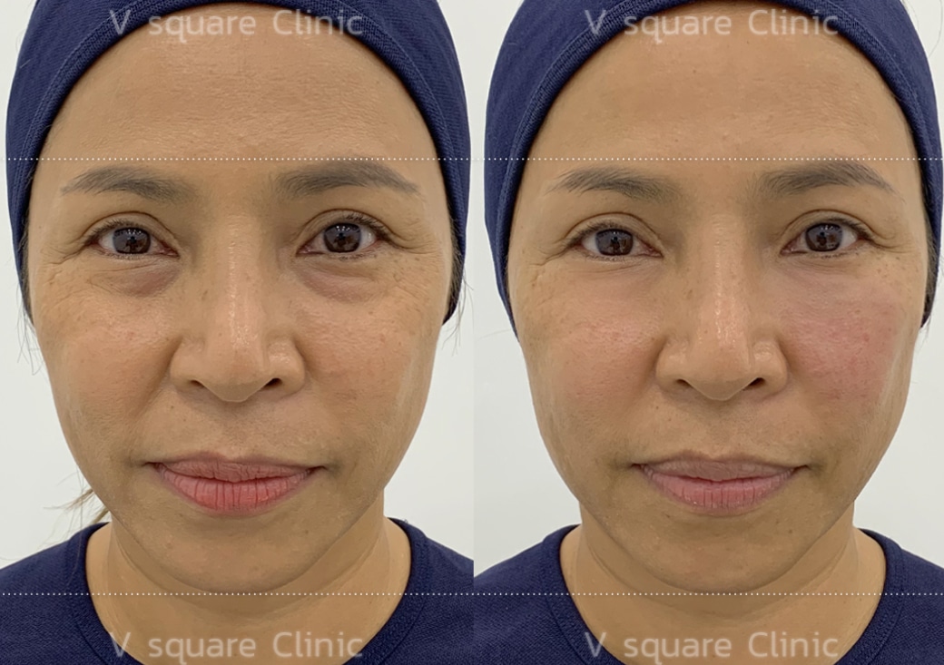 B&A_1040x733.1