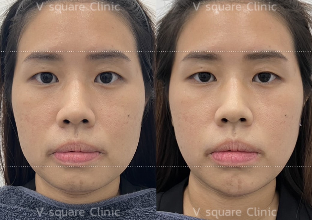 B&A_1040x733.2