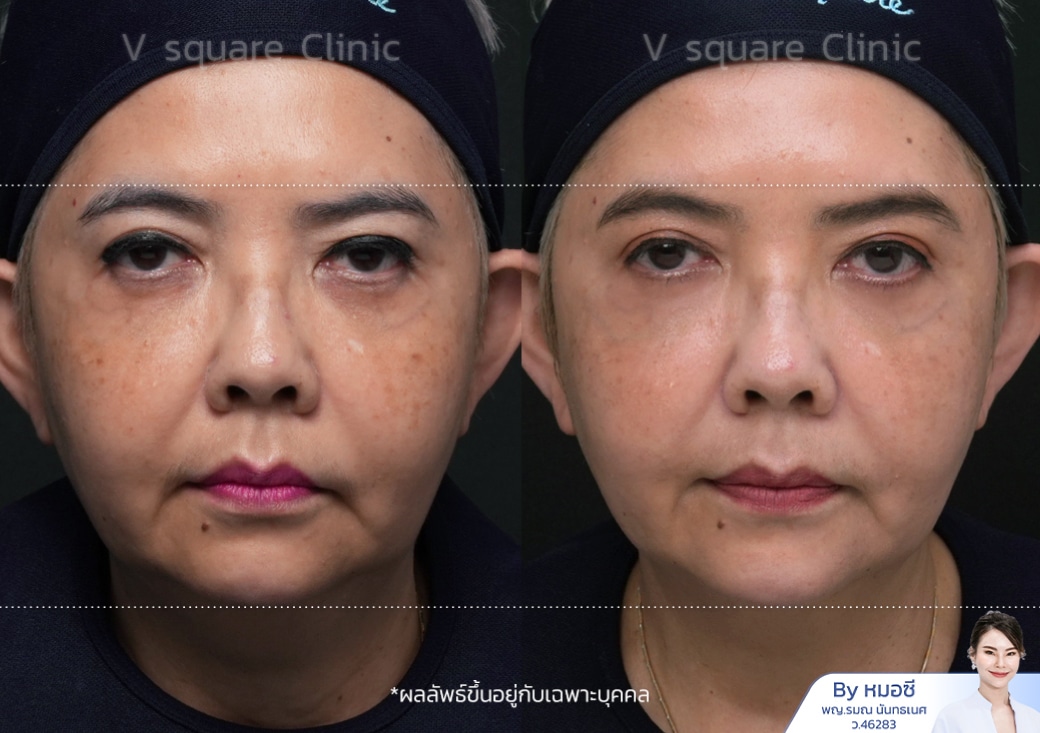B&A_1040x733.2