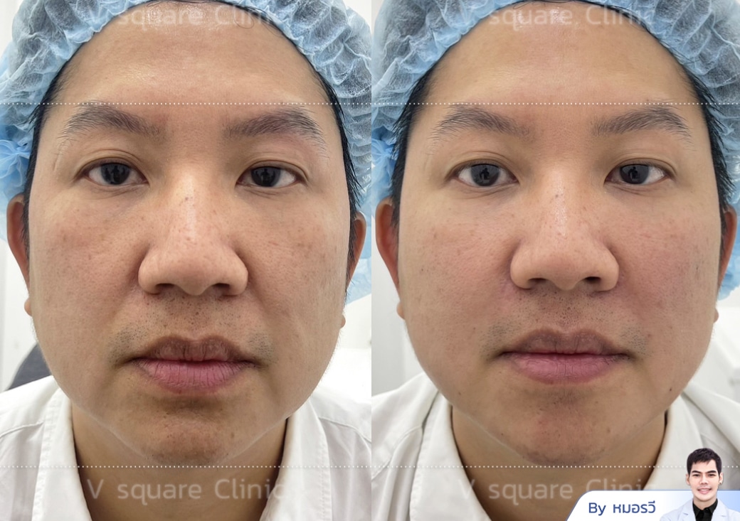 B&A_1040x733.3